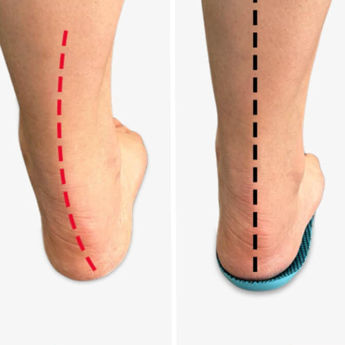 Podianova | Ergonomische inlegzolen