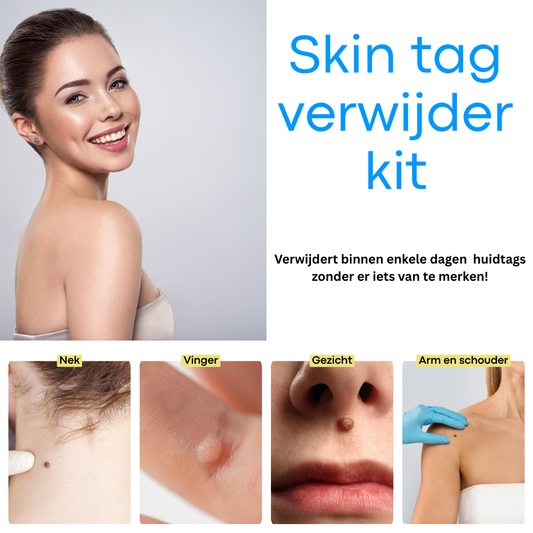 Skinova | Skin Tag Verwijderkit